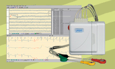 holter zdarzeniowy ekg